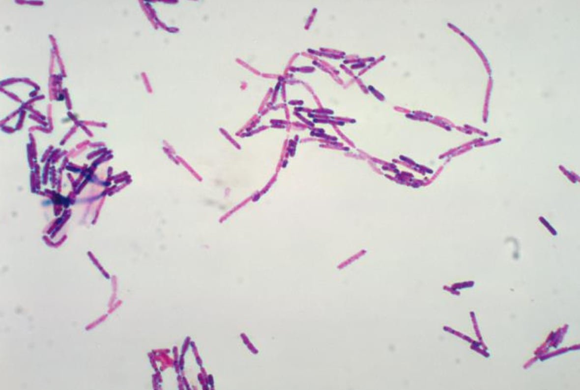bacillus-cereus Numerous, Gram-positive, Bacillus cereus bacteria are seen in a photomicrograph.