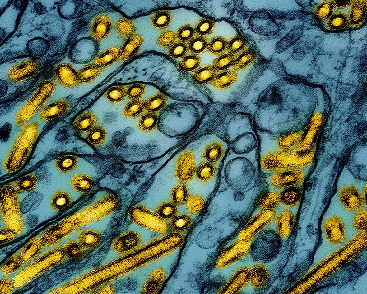 bird-flu-3 A sea of blue membranes punctuated by yellow circles and sticks.