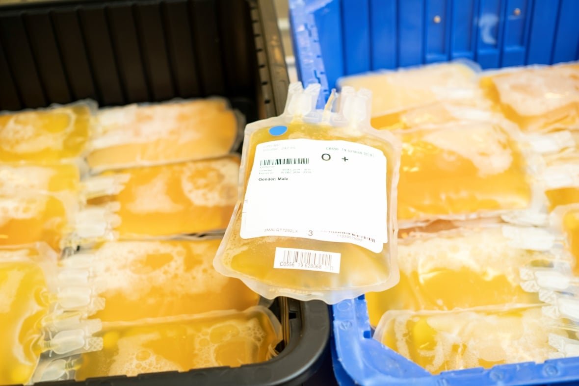 blood-plasma-1 Yellow liquid in a medical bag.