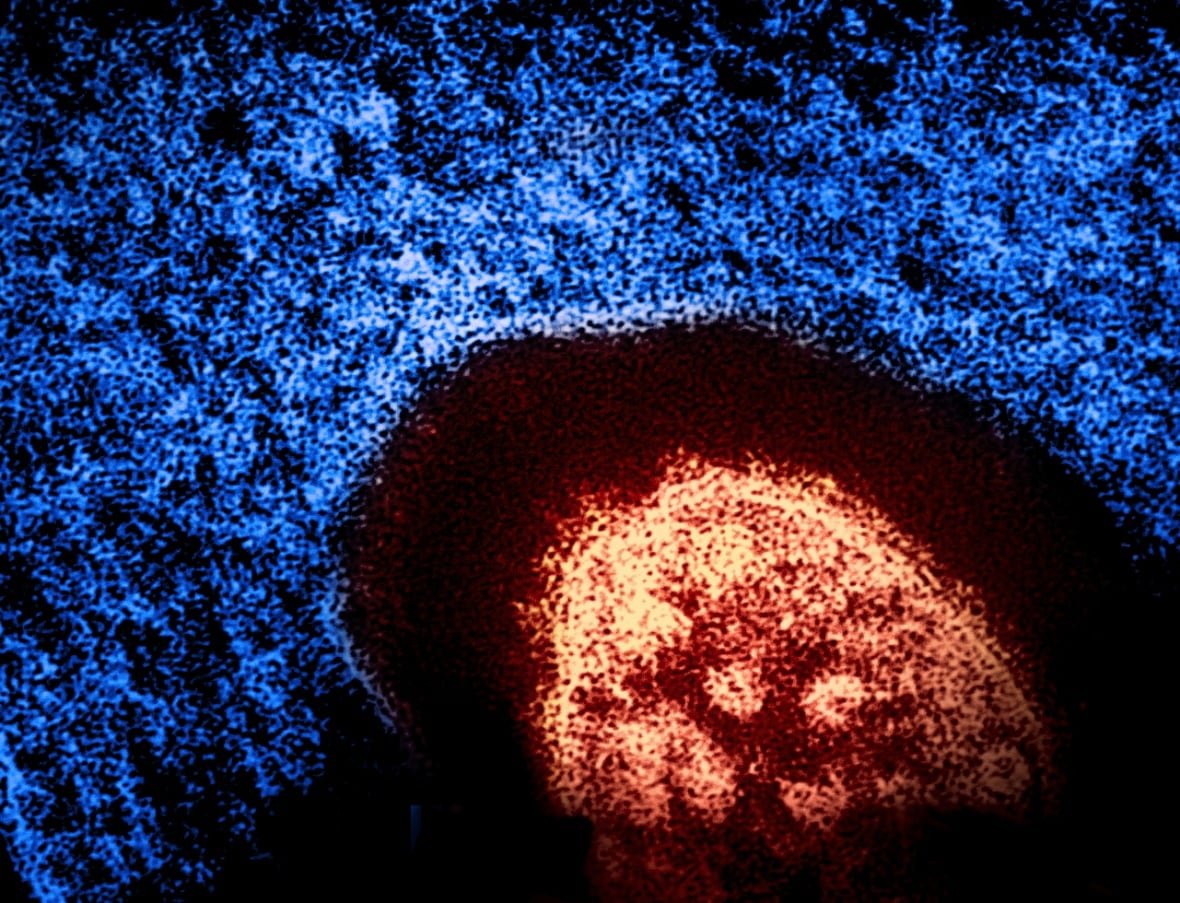 measles-virus-particle Colorized transmission electron micrograph of a measles virus particle.