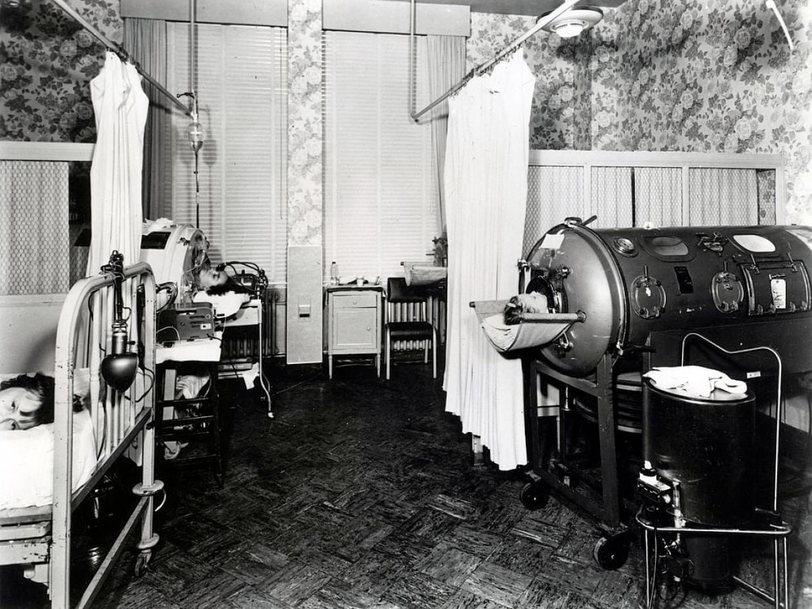 polio-ward A black and white photograph that depicts a polio ward in the 20th century.