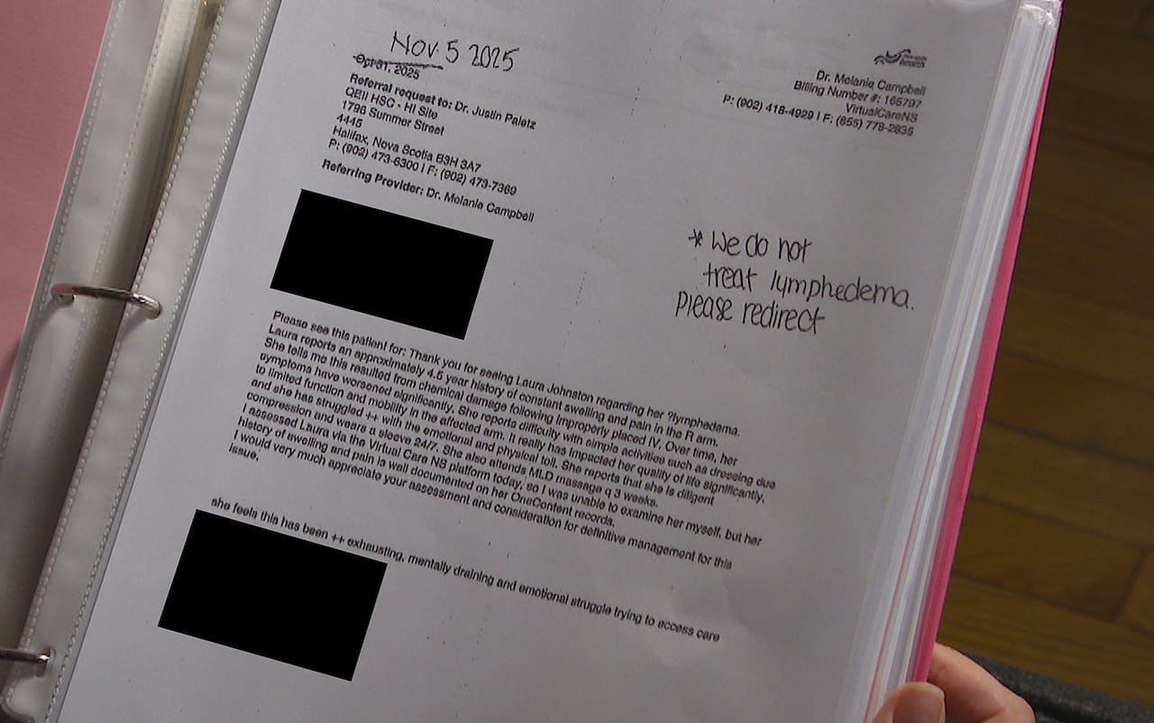 A referral letter is shown with a handwritten note stating "we do not treat lymphedema. Please redirect."
